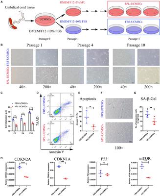 Human Platelet Lysate Maintains Stemness of Umbilical Cord-Derived Mesenchymal Stromal Cells and Promote Lung Repair in Rat Bronchopulmonary Dysplasia